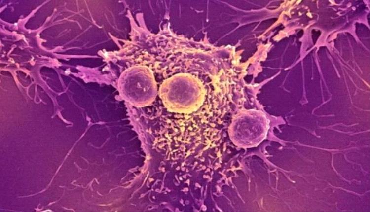 فيروس نباتي يحول المناعة إلى سلاح ضد السرطان