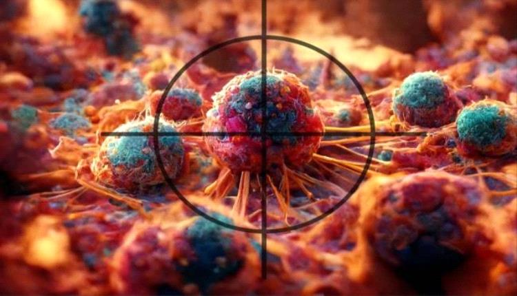 «ليبايداو».. ابتكار دوائي يعد بثورة في علاج الأورام الخبيثة