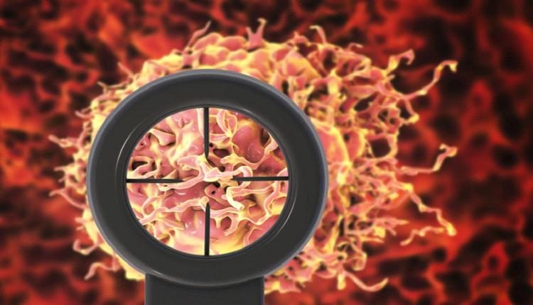 اكتشاف قد يحدث ثورة في علاج السرطان.. 