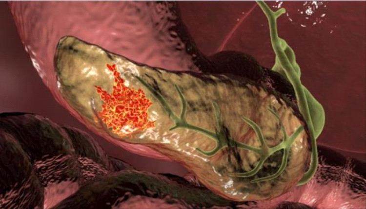 تجربة دوائية رائدة تحقق 