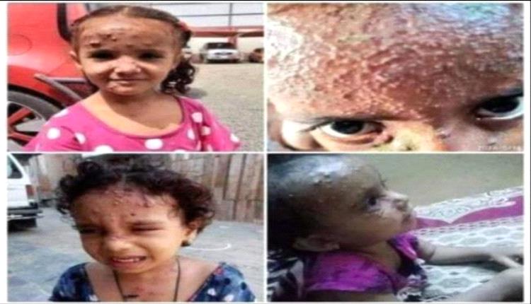 عدن تحت لهيب المعاناة.. انهيار الخدمات يفجّر الغضب الشعبي والنساء يتصدرن المشهد الاحتجاجي