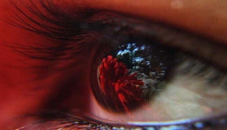 دواء معروف للسكري قد ينقذ العين من حالة خطيرة!  