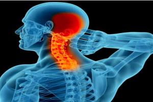 تعرف على الأعراض الأولية للانزلاق الغضروفي في الرقبة